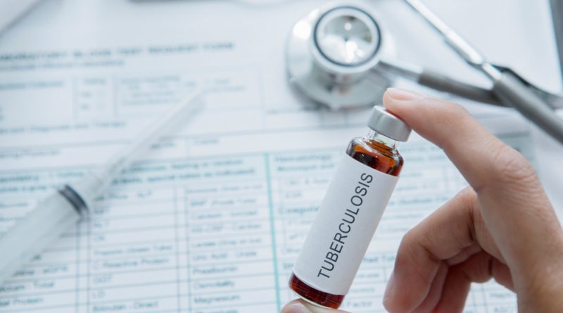 Tuberculosis Vaccine Treatment